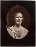 Figure 54 Abaissement volontaire de la mchoire infrieure mouvement inexpressif by Guillaume-Benjamin-Amand Duchenne (de Boulogne) (French, 1806–1875) - Classic Art canvas print